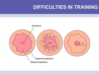 DIFFICULTIES IN TRAINING
 