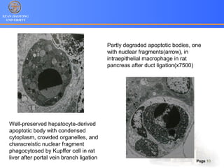 XI’AN JIAOTONG
UNIVERSITY
Page 10
Partly degraded apoptotic bodies, one
with nuclear fragments(arrow), in
intraepithelial macrophage in rat
pancreas after duct ligation(x7500)
Well-preserved hepatocyte-derived
apoptotic body with condensed
cytoplasm, crowded organelles, and
characreistic nuclear fragment
phagocytosed by Kupffer cell in rat
liver after portal vein branch ligation
 