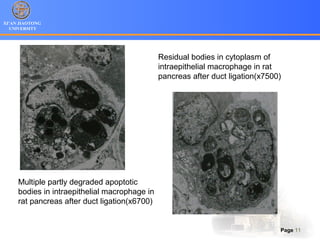 XI’AN JIAOTONG
UNIVERSITY
Page 11
Multiple partly degraded apoptotic
bodies in intraepithelial macrophage in
rat pancreas after duct ligation(x6700)
Residual bodies in cytoplasm of
intraepithelial macrophage in rat
pancreas after duct ligation(x7500)
 