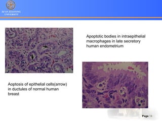 XI’AN JIAOTONG
UNIVERSITY
Page 14
Aoptosis of epithelial cells(arrow)
in ductules of normal human
breast
Apoptotic bodies in intraepithelial
macrophages in late secretory
human endometrium
 