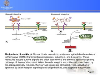 XI’AN JIAOTONG
UNIVERSITY
Page 27
Mechanisms of anoikis. A. Normal. Under normal circumstances, epithelial cells are bound
to their native ECM by transmembrane molecules, including α- and β-integrins. These
molecules activate survival signals and block both intrinsic and extrinsic apoptotic signaling
pathways. B. Loss of attachment. When the cell’s integrins are not bound, or not bound by
the appropriate ECM moieties, their survival signals are eliminated. Then, activation of
apoptosis by death receptor signaling is no longer blocked, and apoptosis may proceed.
 