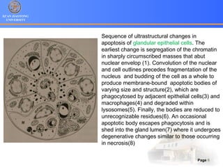 XI’AN JIAOTONG
UNIVERSITY
Page 6
Sequence of ultrastructural changes in
apoptosis of glandular epithelial cells. The
earliest change is segregation of the chromatin
in sharply circumscribed masses that abut
nuclear envelop (1). Convolution of the nuclear
and cell outlines precedes fragmentation of the
nucleus and budding of the cell as a whole to
produce membrane-bound apoptotic bodies of
varying size and structure(2), which are
phagocytosed by adjacent epithelial cells(3) and
macrophages(4) and degraded within
lysosomes(5). Finally, the bodies are reduced to
unrecognizable residues(6). An occasional
apoptotic body escapes phagocytosis and is
shed into the gland lumen(7) where it undergoes
degenerative changes similar to those occurring
in necrosis(8)
 