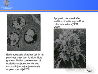 XI’AN JIAOTONG
UNIVERSITY
Page 7
Early apoptosis of acinar cell in rat
pancreas after duct ligation. Note
granular fibrillar core remnant of
nucleolus adjacent condensed
chromatin(arrow) adjacent cells
appear normal(x6200)
Apoptotic HeLa cell after
addition of actinomycin D to
cultured medium(SEM
x9000)
 