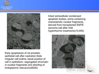 XI’AN JIAOTONG
UNIVERSITY
Page 8
Early apoptotosis of rat prostatic
epithelial cell after castration.Note
irregular cell outline, basal position of
cell in epithelium, segregated chromatin
in nuclear fragments and whorling of
endoplasmic reticulum(x8200)
Intact extracellular condensed
apoptotic bodies, some containing
characteristic nuclear fragments,
derived from transplanted EMT6
sarcoma cell after mild
hyperthermic treatment(x10,000)
 