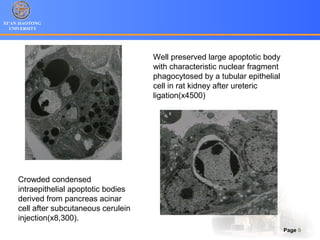 XI’AN JIAOTONG
UNIVERSITY
Page 9
Crowded condensed
intraepithelial apoptotic bodies
derived from pancreas acinar
cell after subcutaneous cerulein
injection(x8,300).
Well preserved large apoptotic body
with characteristic nuclear fragment
phagocytosed by a tubular epithelial
cell in rat kidney after ureteric
ligation(x4500)
 