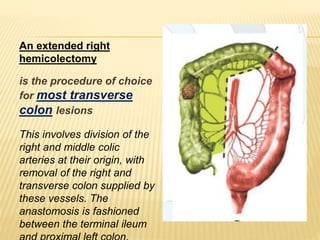 TREATMENT OF RIGHT COLONIC CANCER | PPTX