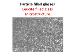 Dental ceramics (Composition,Microstructure and Applications) | PPTX