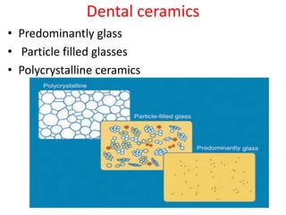 Dental ceramics (Composition,Microstructure and Applications) | PPTX