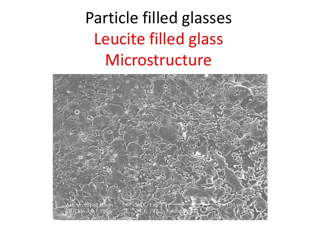 Dental ceramics and Applications)