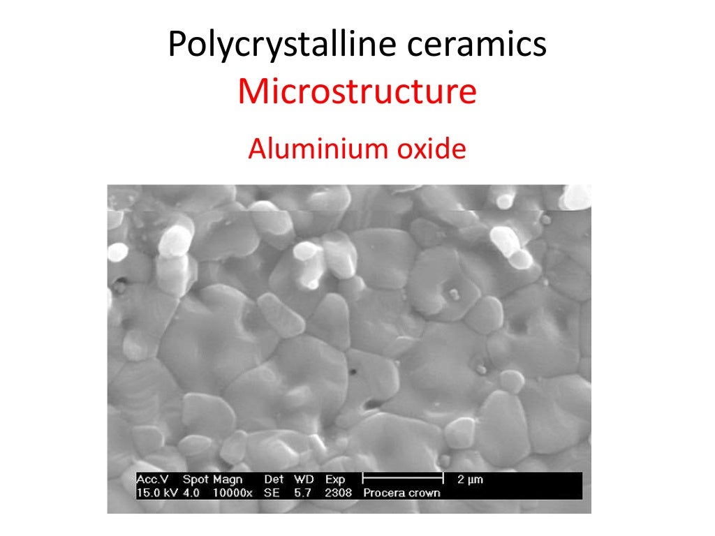 Dental ceramics and Applications)