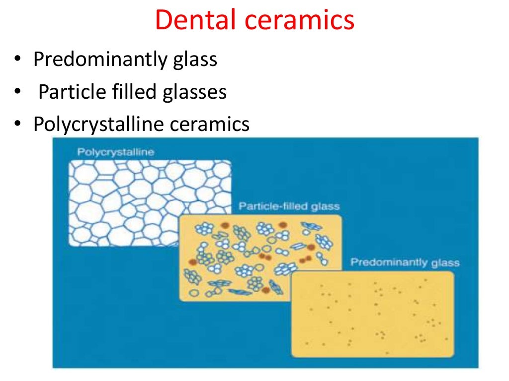 Dental ceramics and Applications)