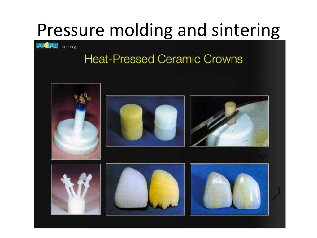 Dental ceramics and Applications)