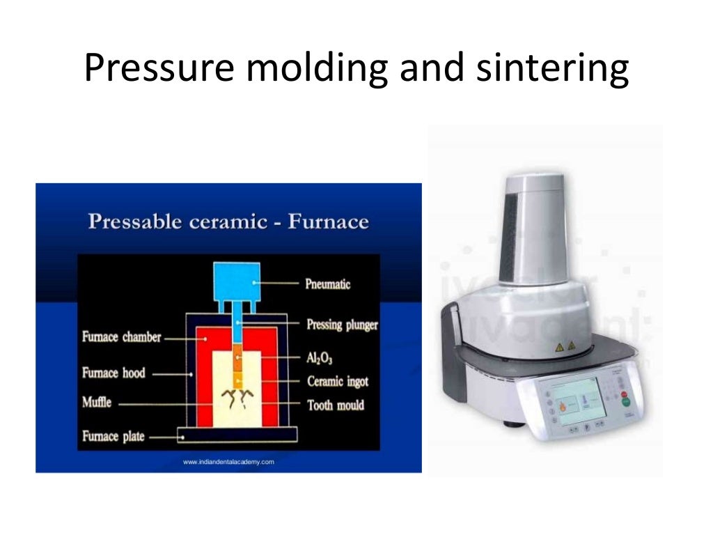 Dental ceramics and Applications)