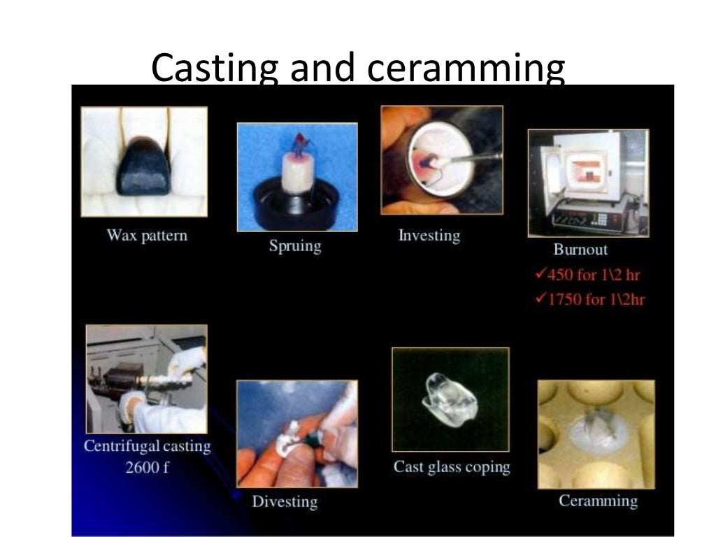 Dental ceramics and Applications)