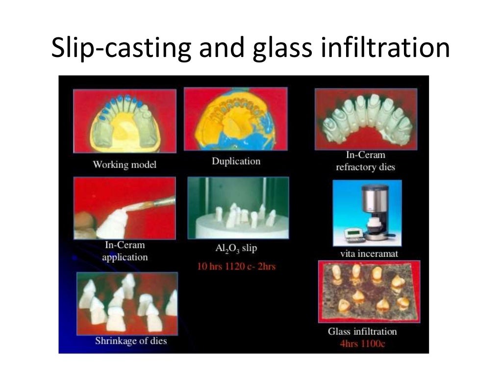 Dental ceramics and Applications)