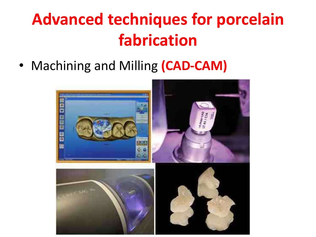 Dental ceramics and Applications)