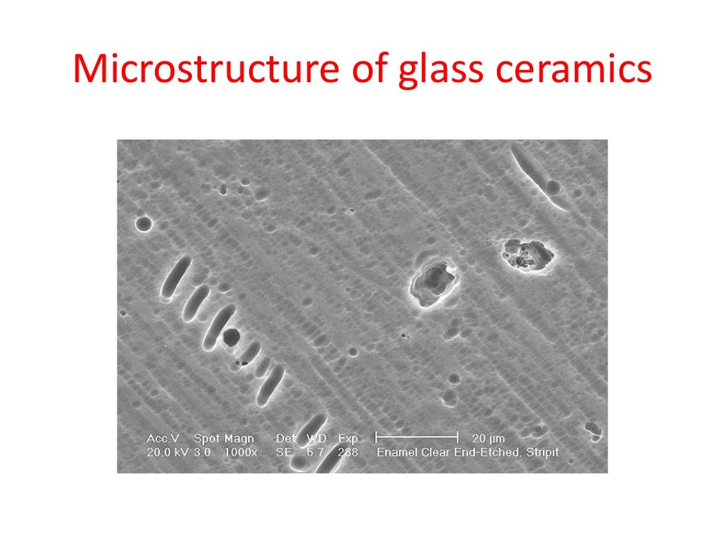 Dental ceramics and Applications)