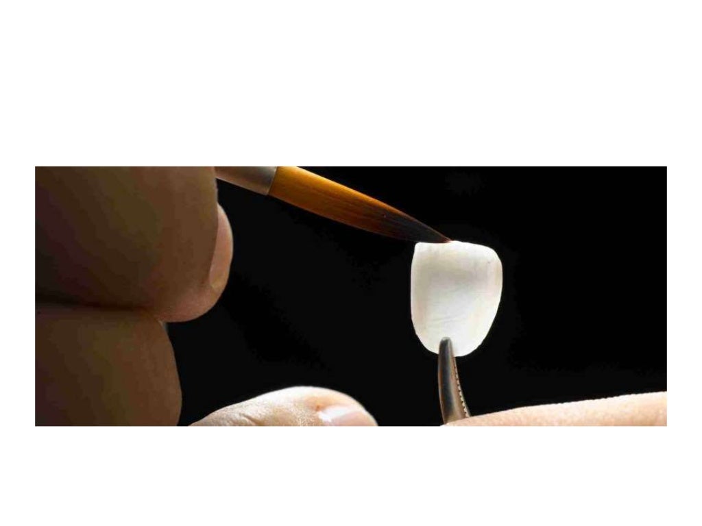 Dental ceramics and Applications)