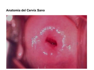 Anatomìa del Cervix Sano
 
