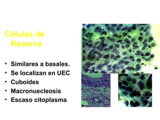 Cèlulas de
Reserva
• Similares a basales.
• Se localizan en UEC
• Cuboides
• Macronuecleosis
• Escaso citoplasma.
 