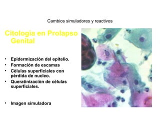 Cambios simuladores y reactivos
Citologìa en Prolapso
Genital
• Epidermizaciòn del epitelio.
• Formaciòn de escamas
• Cèlu...