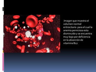 Imagen que muestra el
volumen normal
eritrocitario para el cual la
anemia perniciosa esta
disminuido y se encuentra
muy bajo por deficiencia
en la absorción de
vitamina B12
 