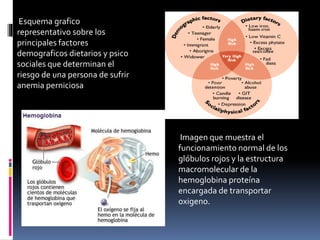 Esquema grafico
representativo sobre los
principales factores
demograficos dietarios y psico
sociales que determinan el
riesgo de una persona de sufrir
anemia perniciosa
Imagen que muestra el
funcionamiento normal de los
glóbulos rojos y la estructura
macromolecular de la
hemoglobina proteína
encargada de transportar
oxigeno.
 
