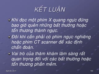 100April 25, 2017
KEÁT LUAÄN
Khi ñoïc moät phim X quang ngöïc ñöøng
bao giôø queân nhöõng baát thöôøng hoaëc
toån thöông thaønh ngöïc.
Ñoâi khi caàn phaûi coù phim ngöïc nghieâng
hoaëc phim CT scanner ñeå xaùc ñònh
chaån ñoaùn.
Vai troø cuûa thaêm khaùm laâm saøng raát
quan troïng ñoái vôùi caùc baát thöôøng hoaëc
toån thöông phaàn meàm.
 