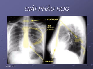 7April 25, 2017
GIAÛI PHAÃU HOÏC
 