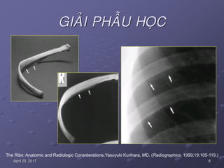 8April 25, 2017
GIAÛI PHAÃU HOÏC
The Ribs: Anatomic and Radiologic Considerations.Yasuyuki Kurihara, MD. (Radiographics. 1999;19:105-119.)
 