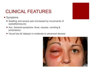 CLINICAL FEATURES
 Symptoms
 Swelling and severe pain (increased by movements of
eyeball/pressure)
 Ass. General symptoms- fever, nausea, vomiting &
prostrations
 Visual loss &/ diplopia in moderate to advanced disease
 