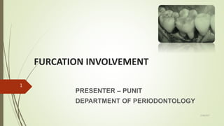 FURCATION INVOLVEMENT
PRESENTER – PUNIT
DEPARTMENT OF PERIODONTOLOGY
1
5/28/2017
 
