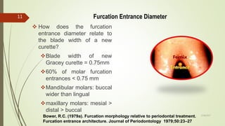 Furcation Entrance Diameter
 How does the furcation
entrance diameter relate to
the blade width of a new
curette?
Blade width of new
Gracey curette = 0.75mm
60% of molar furcation
entrances < 0.75 mm
Mandibular molars: buccal
wider than lingual
maxillary molars: mesial >
distal > buccal
Bower, R.C. (1979a). Furcation morphology relative to periodontal treatment.
Furcation entrance architecture. Journal of Periodontology 1979;50:23–27
11
5/28/2017
 