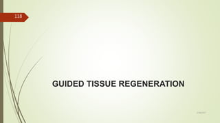 GUIDED TISSUE REGENERATION
118
5/28/2017
 