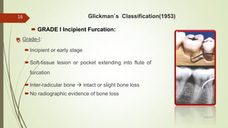 Glickman`s Classification(1953)
 GRADE I Incipient Furcation:
 Grade-I:
Incipient or early stage
Soft-tissue lesion or pocket extending into flute of
furcation
Inter-radicular bone  intact or slight bone loss
No radiographic evidence of bone loss
16
5/28/2017
 