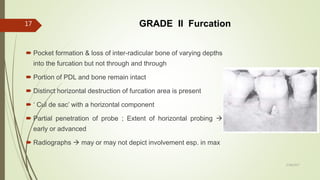 GRADE II Furcation
 Pocket formation & loss of inter-radicular bone of varying depths
into the furcation but not through and through
 Portion of PDL and bone remain intact
 Distinct horizontal destruction of furcation area is present
 ‘ Cul de sac’ with a horizontal component
 Partial penetration of probe ; Extent of horizontal probing 
early or advanced
 Radiographs  may or may not depict involvement esp. in max
17
5/28/2017
 