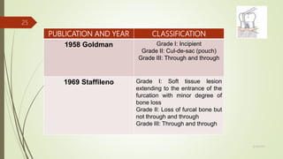 PUBLICATION AND YEAR CLASSIFICATION
1958 Goldman Grade I: Incipient
Grade II: Cul-de-sac (pouch)
Grade III: Through and through
1969 Staffileno Grade I: Soft tissue lesion
extending to the entrance of the
furcation with minor degree of
bone loss
Grade II: Loss of furcal bone but
not through and through
Grade III: Through and through
25
5/28/2017
 