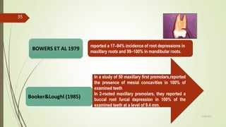 BOWERS ET AL 1979
reported a 17–94% incidence of root depressions in
maxillary roots and 99–100% in mandibular roots.
Booker&Loughl (1985)
In a study of 50 maxillary first premolars,reported
the presence of mesial concavities in 100% of
examined teeth
In 2-rooted maxillary premolars, they reported a
buccal root furcal depression in 100% of the
examined teeth at a level of 9.4 mm.
35
5/28/2017
 