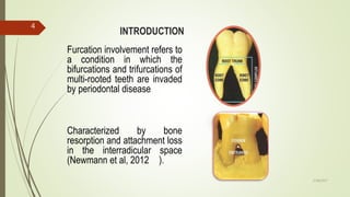 INTRODUCTION
Furcation involvement refers to
a condition in which the
bifurcations and trifurcations of
multi-rooted teeth are invaded
by periodontal disease
Characterized by bone
resorption and attachment loss
in the interradicular space
(Newmann et al, 2012 ).
4
5/28/2017
 