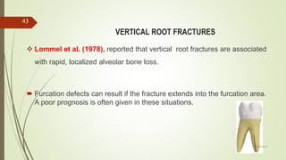 VERTICAL ROOT FRACTURES
 Lommel et al. (1978), reported that vertical root fractures are associated
with rapid, localized alveolar bone loss.
 Furcation defects can result if the fracture extends into the furcation area.
A poor prognosis is often given in these situations.
43
5/28/2017
 