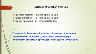 Distance of furcation from CEJ
 Buccal Furcation 3.5 mm apical to CEJ
 Distal Furcation 5 mm apical to CEJ
 Mesial Furcation 3 mm apical to CEJ
Carnevale G, Pontoriero R, Lindhe J. Treatment of furcation-
involved teeth. In: Lindhe J, ed. Clinical periodontology
and implant dentistry. Copenhagen: Munksgaard, 2008; 823-43
49
5/28/2017
 
