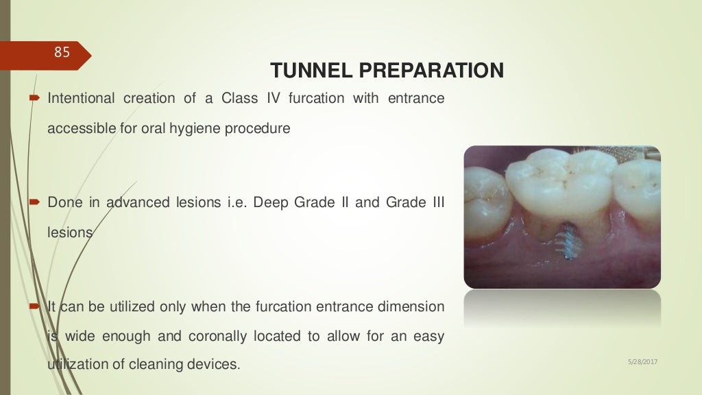 4.furcation involvement and its treatment