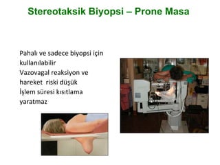 Stereotaksik Biyopsi – Prone Masa
Pahalı ve sadece biyopsi için
kullanılabilir
Vazovagal reaksiyon ve
hareket riski düşük
İşlem süresi kısıtlama
yaratmaz
 