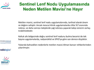 Sentinel Lenf Nodu Uygulamasında
Neden Metilen Mavisi’ne Hayır
Metilen mavisi, sentinel lenf nodu uygulamalarında, tarihsel olarak önem
ve değere sahiptir. Ancak mevcut klinik uygulamalarda ciltte %7 oranında
nekroz, ve daha sonrası takiplerde yağ nekrozu yaparak takip sürecini zorlaş-
tırabilmektedir.
Koltuk altı bölgesinde doğru sentinel lenf nodunu bulma becerisi de tek
başına uygulamalarda, radyonüklid ve SPIO’ya göre son derece düşüktür.
Yukarıda bahsedilen nedenlerle metilen mavisi Alman kanser rehberlerinden
çıkarılmıştır.
 
