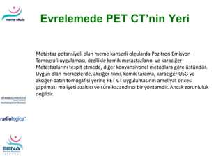 Evrelemede PET CT’nin Yeri
Metastaz potansiyeli olan meme kanserli olgularda Pozitron Emisyon
Tomografi uygulaması, özellikle kemik metastazlarını ve karaciğer
Metastazlarını tespit etmede, diğer konvansiyonel metodlara göre üstündür.
Uygun olan merkezlerde, akciğer filmi, kemik tarama, karaciğer USG ve
akciğer-batın tomogafisi yerine PET CT uygulamasının ameliyat öncesi
yapılması maliyeti azaltıcı ve süre kazandırıcı bir yöntemdir. Ancak zorunluluk
değildir.
 