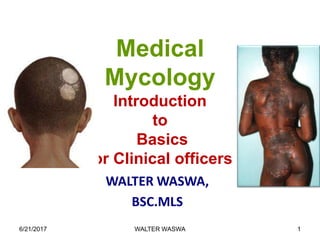 Medical
Mycology
Introduction
to
Basics
for Clinical officers
WALTER WASWA,
BSC.MLS
6/21/2017 WALTER WASWA 1
 