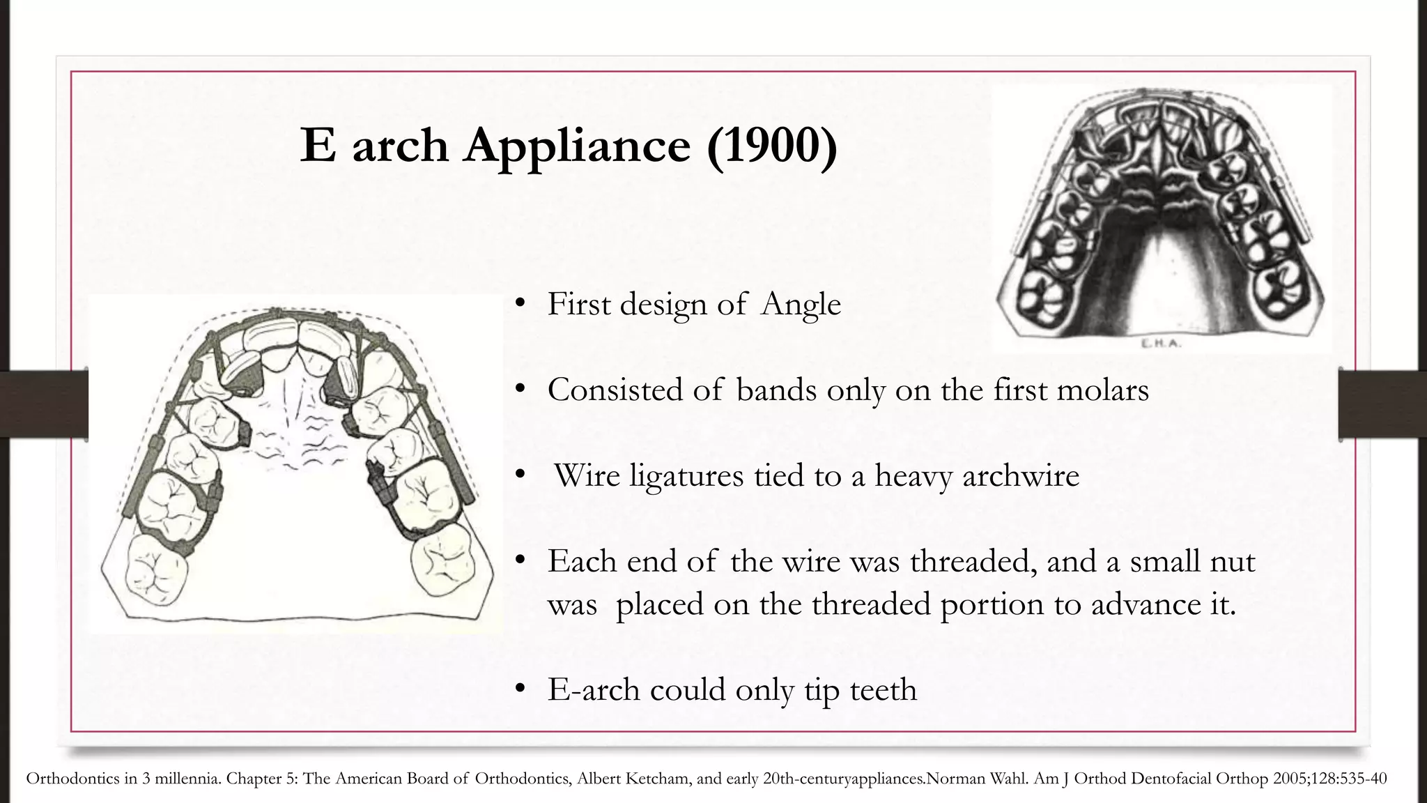• First design of Angle
• Consisted of bands only on the first molars
• Wire ligatures tied to a heavy archwire
• Each end of the wire was threaded, and a small nut
was placed on the threaded portion to advance it.
• E-arch could only tip teeth
E arch Appliance (1900)
Orthodontics in 3 millennia. Chapter 5: The American Board of Orthodontics, Albert Ketcham, and early 20th-centuryappliances.Norman Wahl. Am J Orthod Dentofacial Orthop 2005;128:535-40
 
