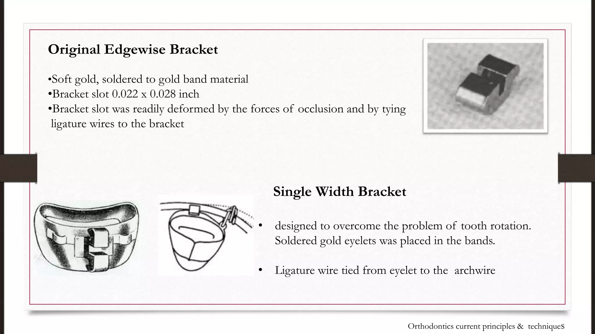Original Edgewise Bracket
•Soft gold, soldered to gold band material
•Bracket slot 0.022 x 0.028 inch
•Bracket slot was readily deformed by the forces of occlusion and by tying
ligature wires to the bracket
Single Width Bracket
• designed to overcome the problem of tooth rotation.
Soldered gold eyelets was placed in the bands.
• Ligature wire tied from eyelet to the archwire
Orthodontics current principles & techniques
 