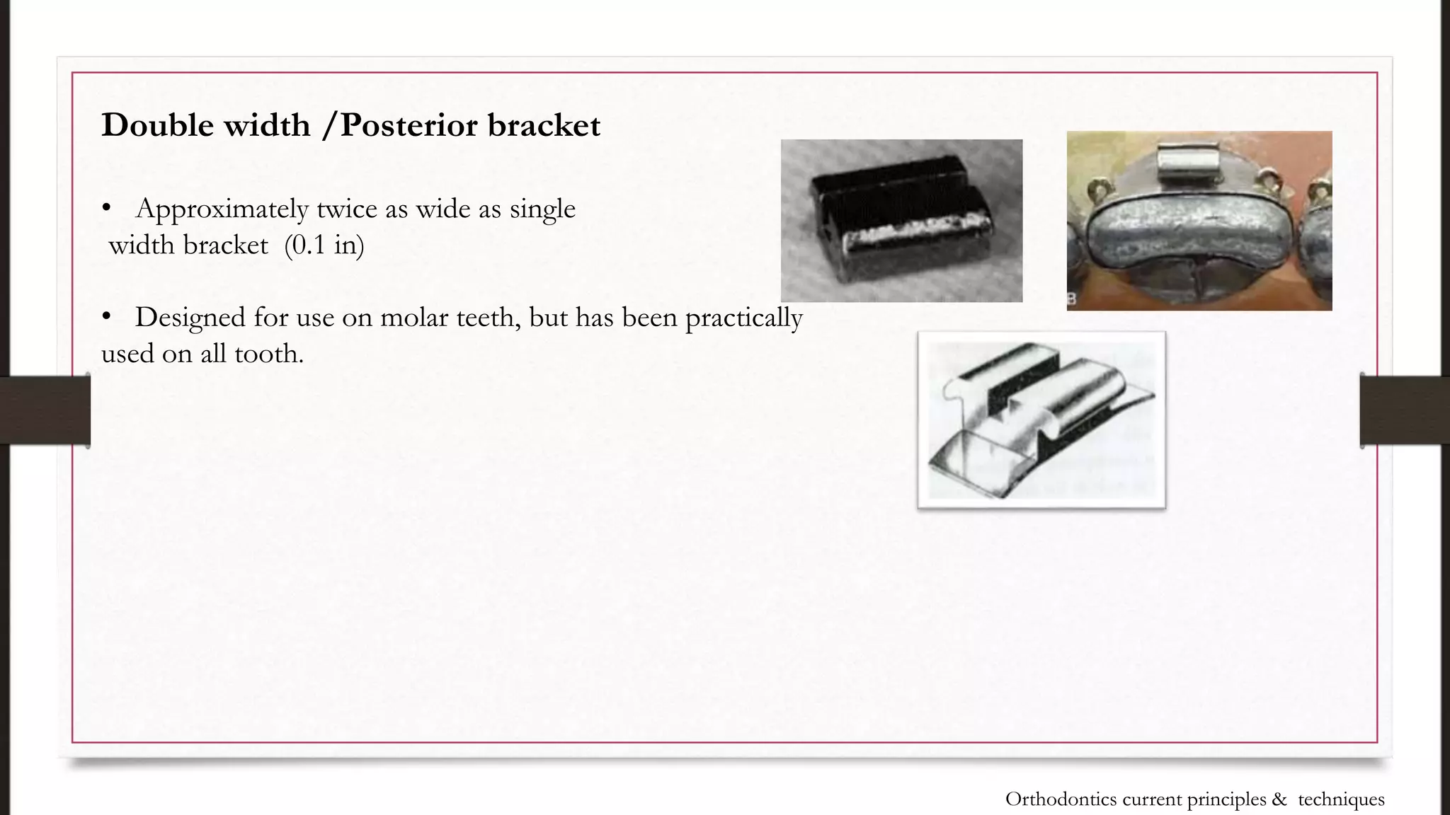 Double width /Posterior bracket
• Approximately twice as wide as single
width bracket (0.1 in)
• Designed for use on molar teeth, but has been practically
used on all tooth.
Orthodontics current principles & techniques
 