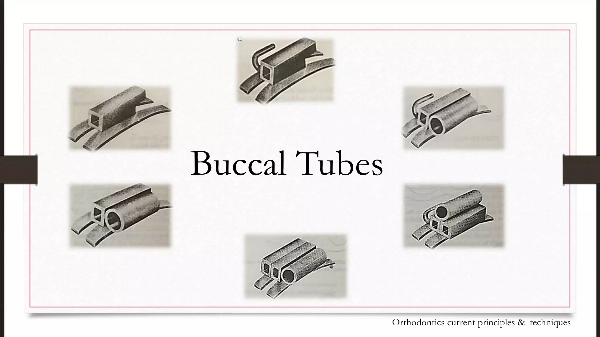 Buccal Tubes
Orthodontics current principles & techniques
 